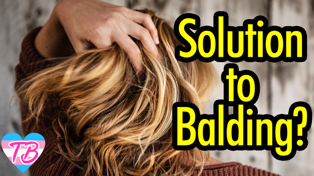 Balding in the Crown Area? Here's How to Combat Hair Loss and Pattern Baldness | MTF Trans Women Tips